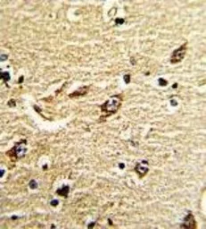 Anti-ND5 antibody, C-term used in IHC (Paraffin sections) (IHC-P). GTX81641
