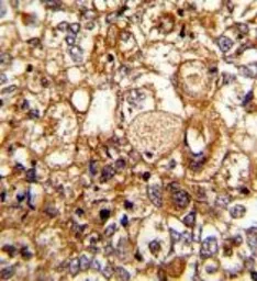 Anti-C6 antibody, N-term used in IHC (Paraffin sections) (IHC-P). GTX81643