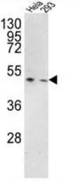 Anti-TMPRSS3 antibody, Internal used in Western Blot (WB). GTX81644
