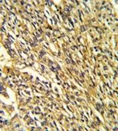 Anti-Kir2.1 antibody, C-term used in IHC (Paraffin sections) (IHC-P). GTX81647