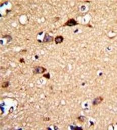 Anti-UNC5C antibody, Internal used in IHC (Paraffin sections) (IHC-P). GTX81651