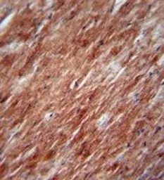 Anti-IL2 antibody, Internal used in IHC (Paraffin sections) (IHC-P). GTX81656