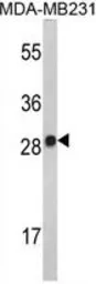 Anti-IL2 antibody, Internal used in Western Blot (WB). GTX81656