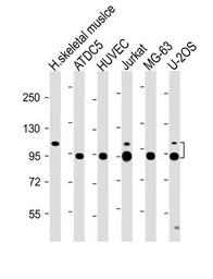 Anti-COMP antibody, Internal used in Western Blot (WB). GTX81660