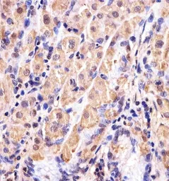 Anti-GSS antibody, C-term used in IHC (Paraffin sections) (IHC-P). GTX81665