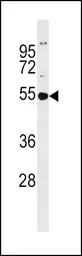 Anti-GSS antibody, C-term used in Western Blot (WB). GTX81665
