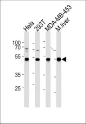 Anti-GSS antibody, C-term used in Western Blot (WB). GTX81665