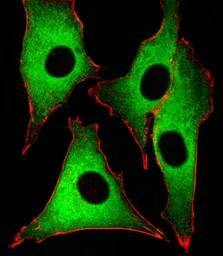 Anti-GSS antibody, C-term used in Immunocytochemistry/ Immunofluorescence (ICC/IF). GTX81665