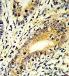 Anti-FAM3B antibody, N-term used in IHC (Paraffin sections) (IHC-P). GTX81667