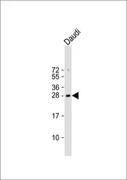 Anti-FAM3B antibody, N-term used in Western Blot (WB). GTX81667