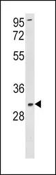 Anti-SOD3 antibody, N-term used in Western Blot (WB). GTX81678