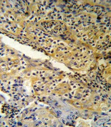 Anti-SPINK5 antibody, N-term used in IHC (Paraffin sections) (IHC-P). GTX81680
