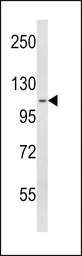 Anti-SPINK5 antibody, N-term used in Western Blot (WB). GTX81680
