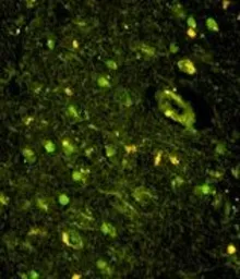 Anti-KHSRP antibody, N-term used in IHC (Paraffin sections) (IHC-P). GTX81683