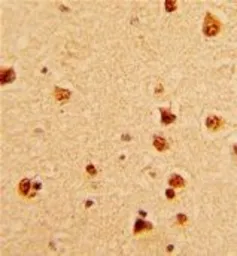 Anti-KHSRP antibody, N-term used in IHC (Paraffin sections) (IHC-P). GTX81683