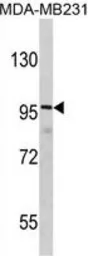 Anti-DLGAP1 antibody, N-term used in Western Blot (WB). GTX81689