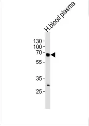 Anti-Fibrinogen alpha antibody, N-term used in Western Blot (WB). GTX81691