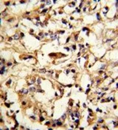 Anti-DFNA5 antibody, N-term used in IHC (Paraffin sections) (IHC-P). GTX81693