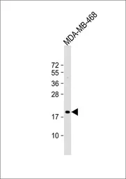 Anti-MAFF antibody, Internal used in Western Blot (WB). GTX81696