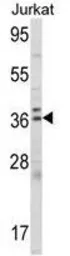 Anti-ALAD antibody, C-term used in Western Blot (WB). GTX81701