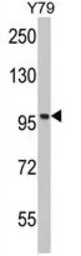 Anti-Importin beta 1 antibody, N-term used in Western Blot (WB). GTX81705