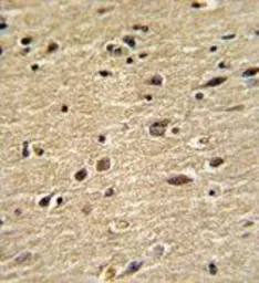 Anti-CUEDC2 antibody, C-term used in IHC (Paraffin sections) (IHC-P). GTX81709