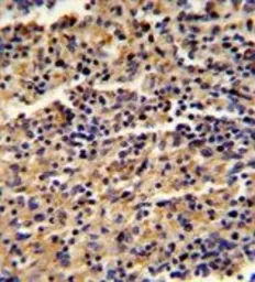 Anti-ALKBH8 antibody, C-term used in IHC (Paraffin sections) (IHC-P). GTX81711
