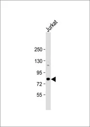 Anti-ALKBH8 antibody, C-term used in Western Blot (WB). GTX81711
