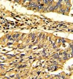 Anti-Hsp 60 antibody, N-term used in IHC (Paraffin sections) (IHC-P). GTX81712