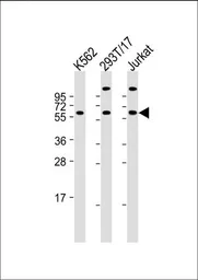 Anti-Hsp 60 antibody, N-term used in Western Blot (WB). GTX81712