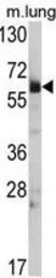 Anti-Hsp 60 antibody, N-term used in Western Blot (WB). GTX81712