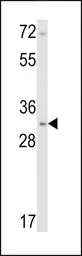 Anti-Calponin 1 antibody, N-term used in Western Blot (WB). GTX81714