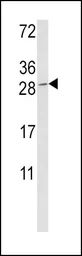 Anti-Granzyme M antibody, Internal used in Western Blot (WB). GTX81716