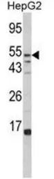 Anti-FUCA1 antibody, Internal used in Western Blot (WB). GTX81717
