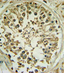 Anti-Wnt1 antibody, C-term used in IHC (Paraffin sections) (IHC-P). GTX81721