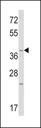 Anti-Wnt1 antibody, C-term used in Western Blot (WB). GTX81721