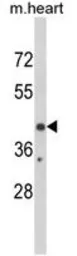 Anti-EGR3 antibody, Internal used in Western Blot (WB). GTX81724