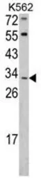 Anti-ITM2A antibody, N-term used in Western Blot (WB). GTX81726