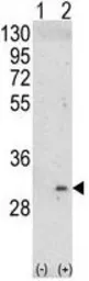 Anti-ITM2A antibody, N-term used in Western Blot (WB). GTX81726