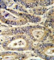 Anti-IGFBP6 antibody, C-term used in IHC (Paraffin sections) (IHC-P). GTX81728
