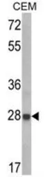 Anti-IGFBP6 antibody, C-term used in Western Blot (WB). GTX81728
