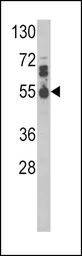 Anti-IL17 Receptor beta antibody, Internal used in Western Blot (WB). GTX81729
