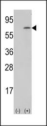 Anti-M-CSF antibody, Internal used in Western Blot (WB). GTX81735