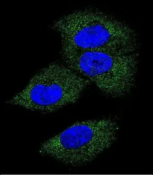 Anti-M-CSF antibody, Internal used in Immunocytochemistry/ Immunofluorescence (ICC/IF). GTX81735