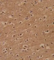 Anti-ZBTB2 antibody, C-term used in IHC (Paraffin sections) (IHC-P). GTX81742
