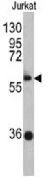 Anti-ZBTB2 antibody, C-term used in Western Blot (WB). GTX81742