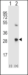 Anti-SPARC antibody, C-term used in Western Blot (WB). GTX81749