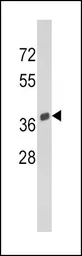 Anti-SPARC antibody, C-term used in Western Blot (WB). GTX81749