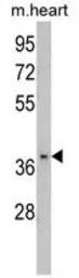 Anti-FBP2 antibody, C-term used in Western Blot (WB). GTX81753