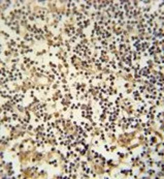 Anti-MAML3 antibody, C-term used in IHC (Paraffin sections) (IHC-P). GTX81755